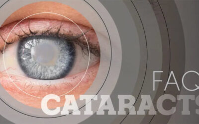 FAQ: Cataracts